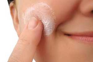 Imagen ilustrativa del artículo Remedios caseros para el acné, tratamiento natural
